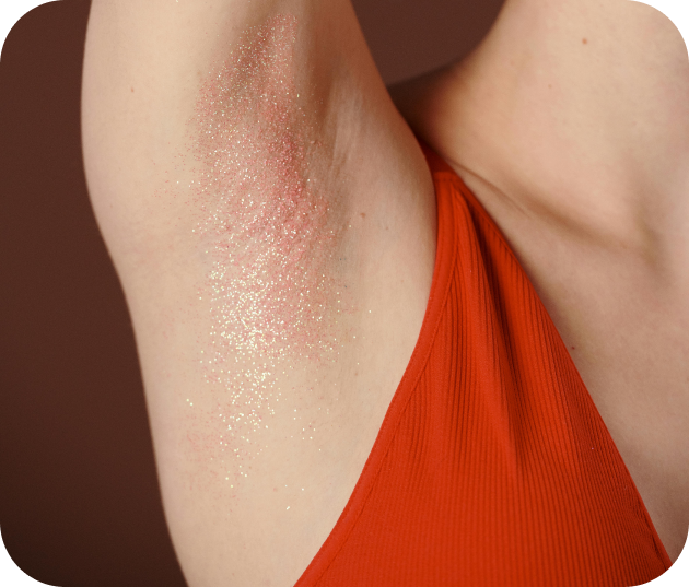 la maladie de verneuil