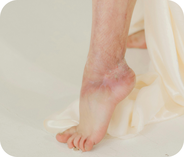 les maladies rares de la peau