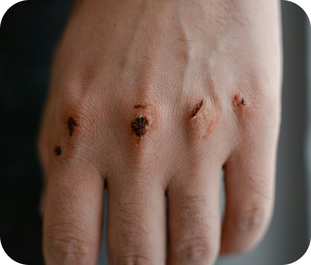 problème de peau : les infections cutanées